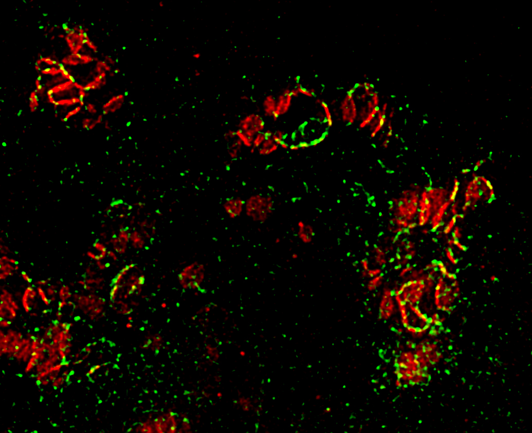 ImageJ=1.50bunit=micron