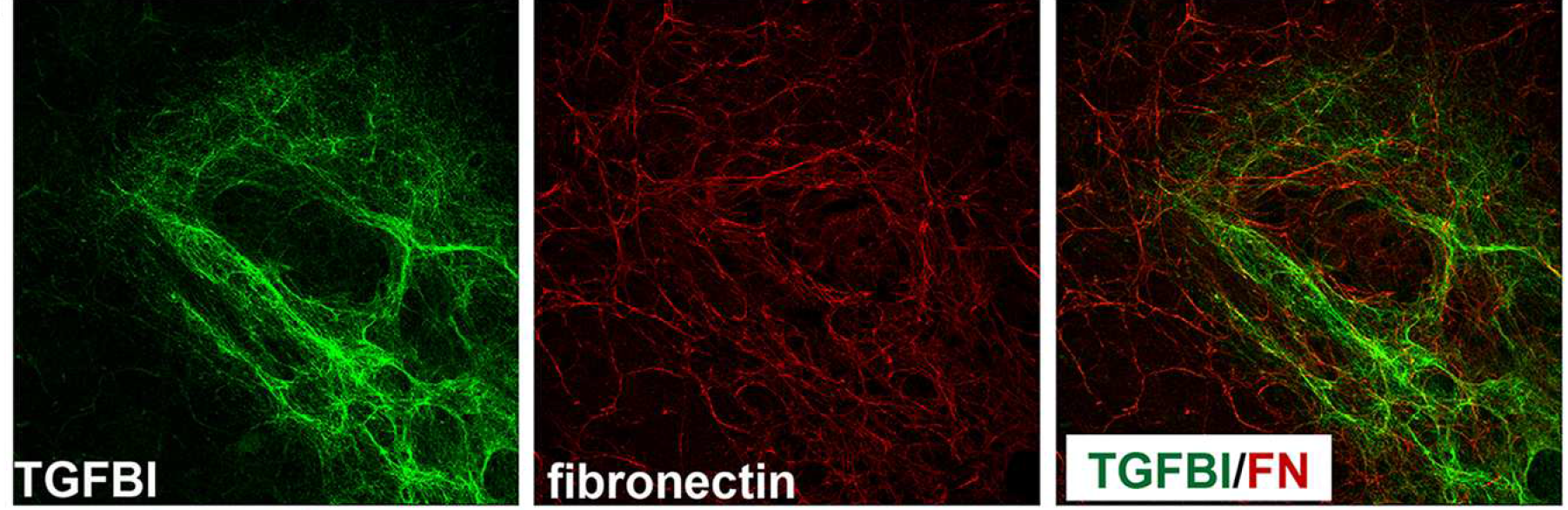 sparc-tgfbi-manuscript-figure